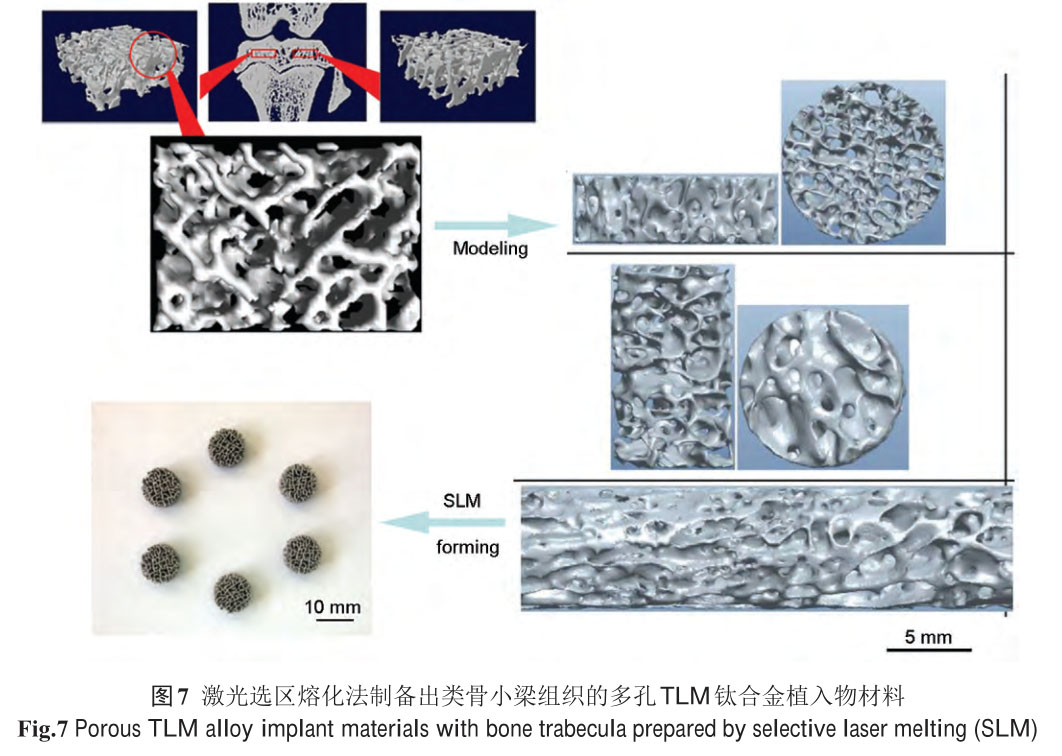 新型醫用鈦合金材料的研發和應用現狀
